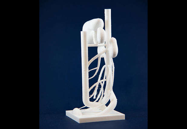 3D Printed sculpture of arterial supply of abdominal viscera
