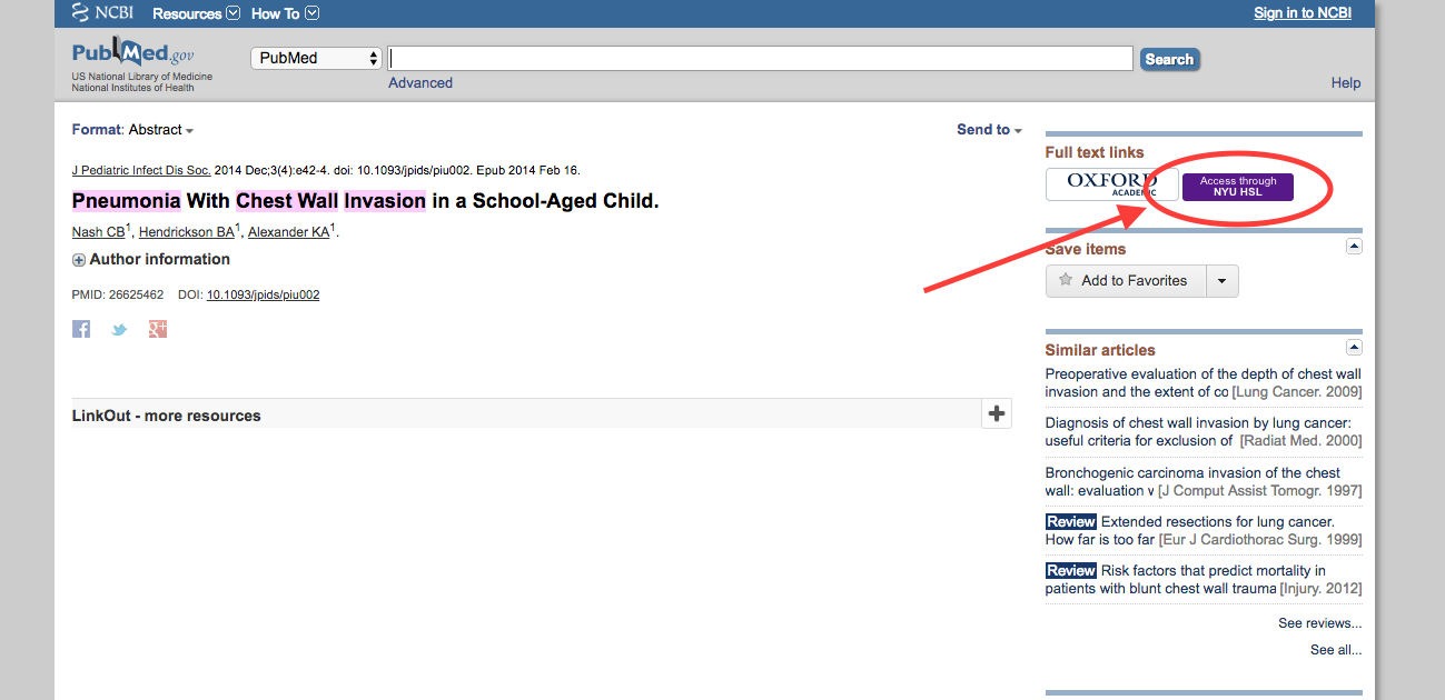 Choosing the NYU HSL access button on PubMed