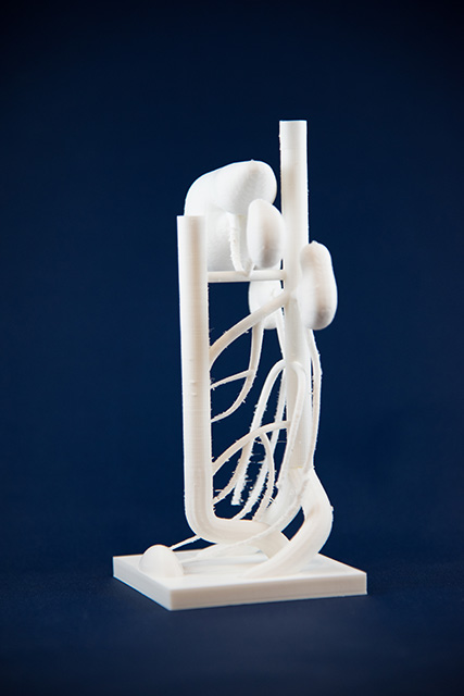 3D Printed sculpture of arterial supply of abdominal viscera