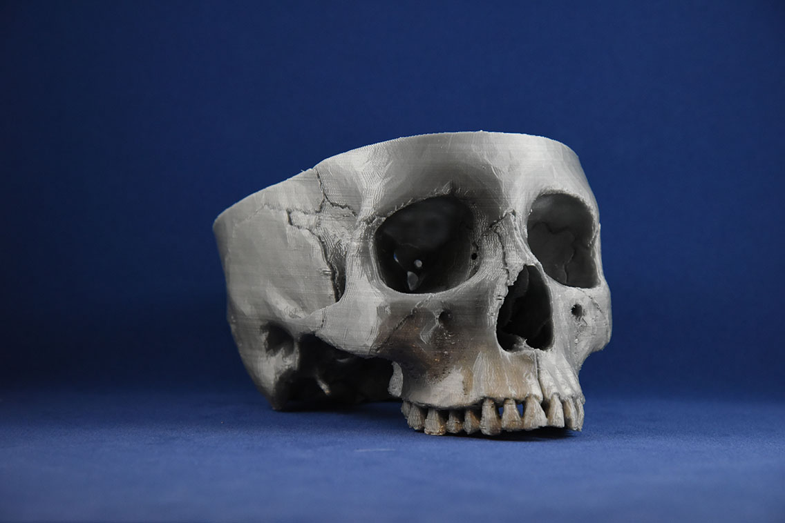 3D Printed Skull